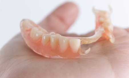 Hand holding a partial denture