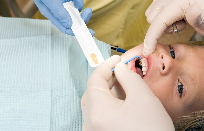 Young patient receiving silver diamine fluoride treatment