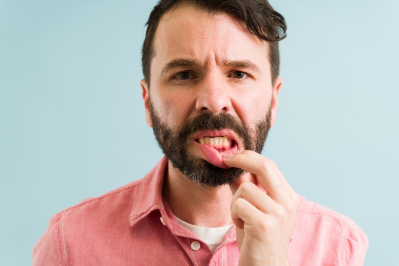 man showing signs of gum disease in Rocky Hill