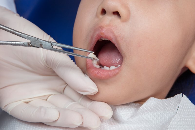 A dentist performing children’s tooth extraction